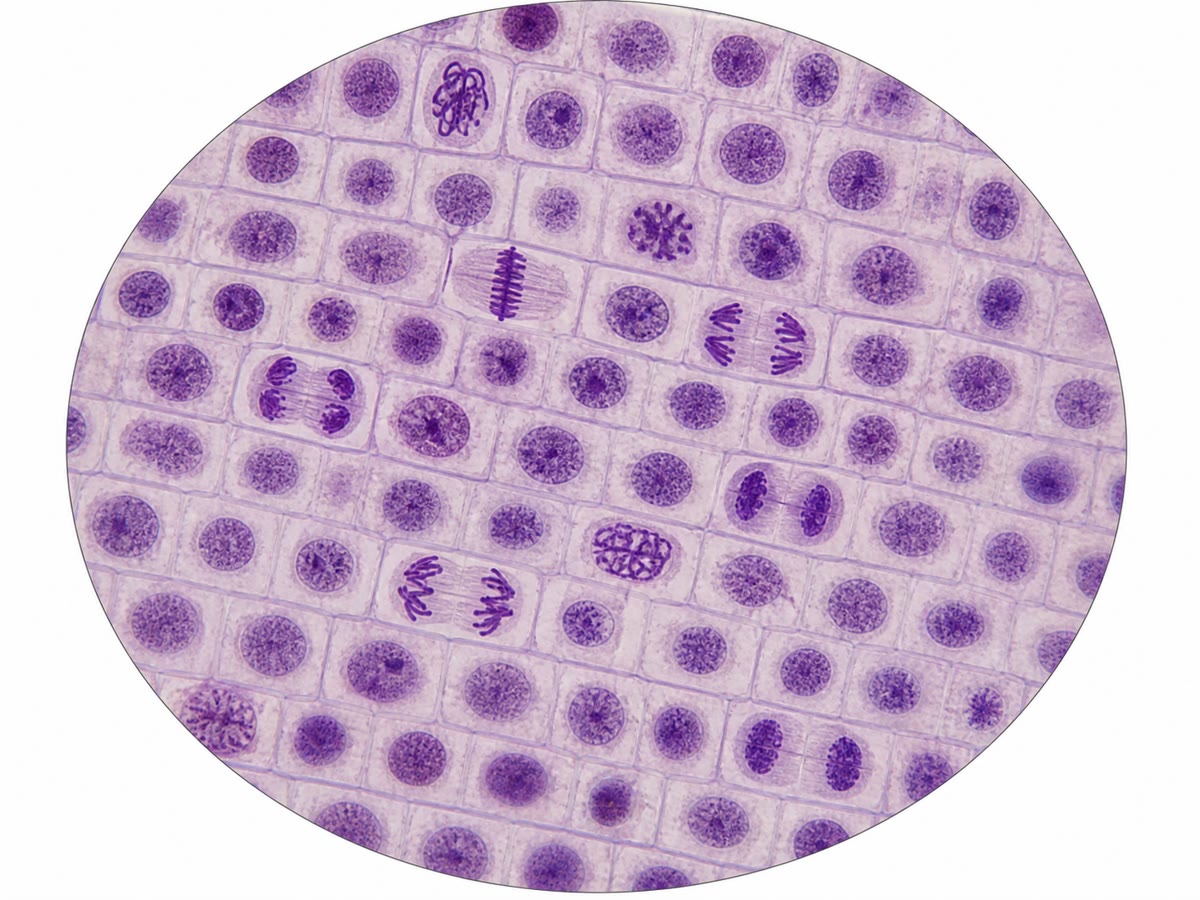 An onion root tip squash under the light microscope. Most cells are in interphase; a few show condensed chromosomes at different stages of mitosis. Counting the proportion in each stage measures how long each stage lasts.