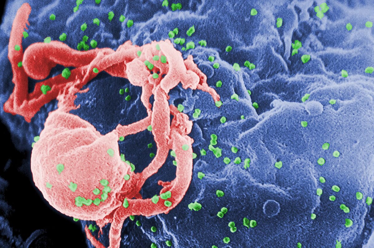 HIV particles (green) budding from the surface of an infected lymphocyte, in a false-coloured electron micrograph. Each particle carries copies of the virus’s genome, and among them the mutants that the next response will not recognise. Micrograph by C. Goldsmith, CDC, public domain.