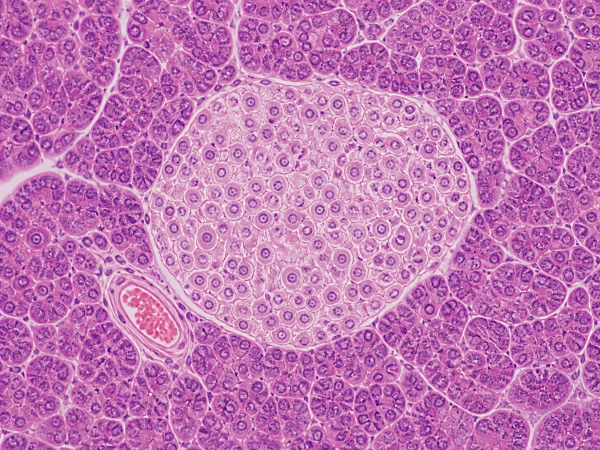 Een doorsnede van de alvleesklier: een eilandje, bleker, tussen de donkerder trosjes cellen die enzymen afscheiden. De cellen van het eilandje lezen de glucose van het bloed af en antwoorden met insuline of glucagon; de rest van het orgaan maakt verteringssap.