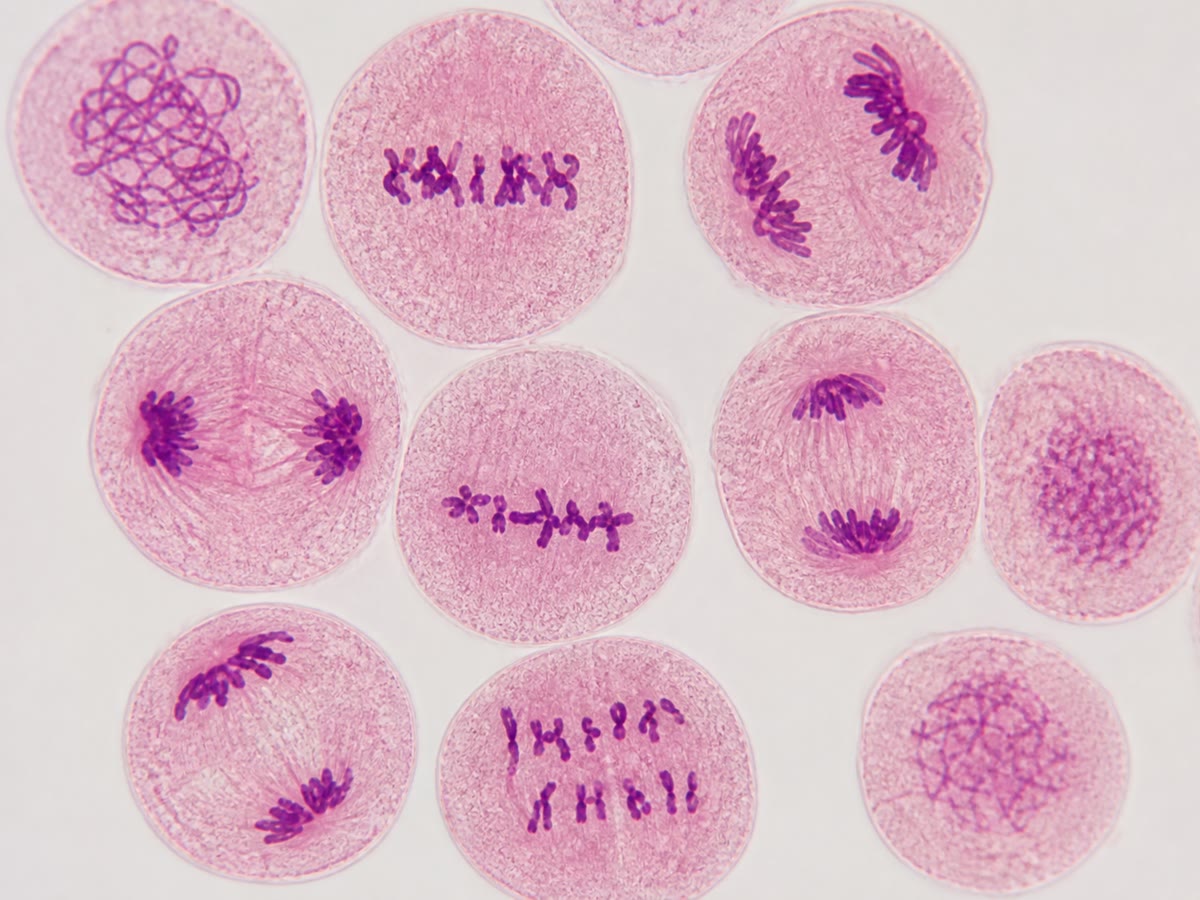Células de uma antera de lírio em meiose, coradas: em algumas, os homólogos emparelhados se alinham no meio da célula; em outras eles já foram puxados para os dois polos. As etapas do esquema, vistas no tecido que fabrica o pólen.