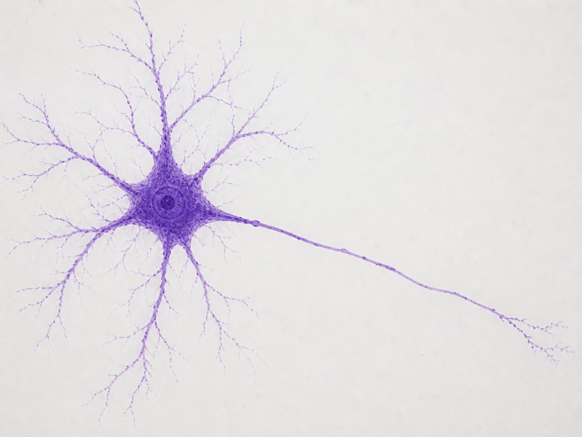 A motor neuron, stained: the cell body with its nucleus, the branching dendrites that receive signals, and the single axon leaving to carry the neuron’s own message to a muscle.