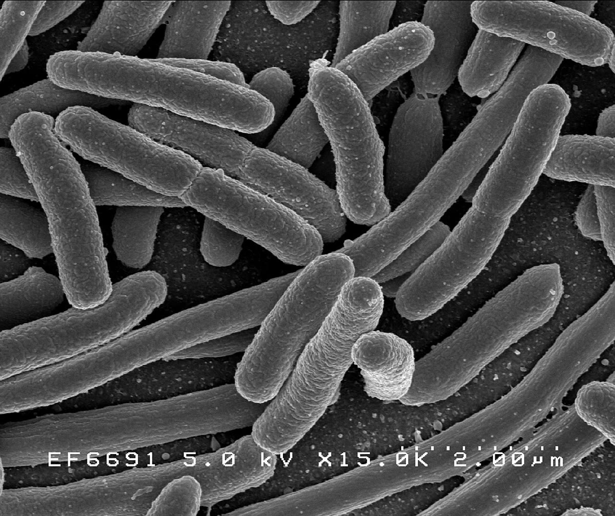 Escherichia coli al microscopio electrónico de barrido (la barra al pie de la imagen mide 2\, µ m). Bastones de 2\, µ m de largo, mil de los cuales cabrían a lo ancho de un milímetro; una sola célula se divide cada veinte minutos en un medio rico. Imagen: NIAID, dominio público.