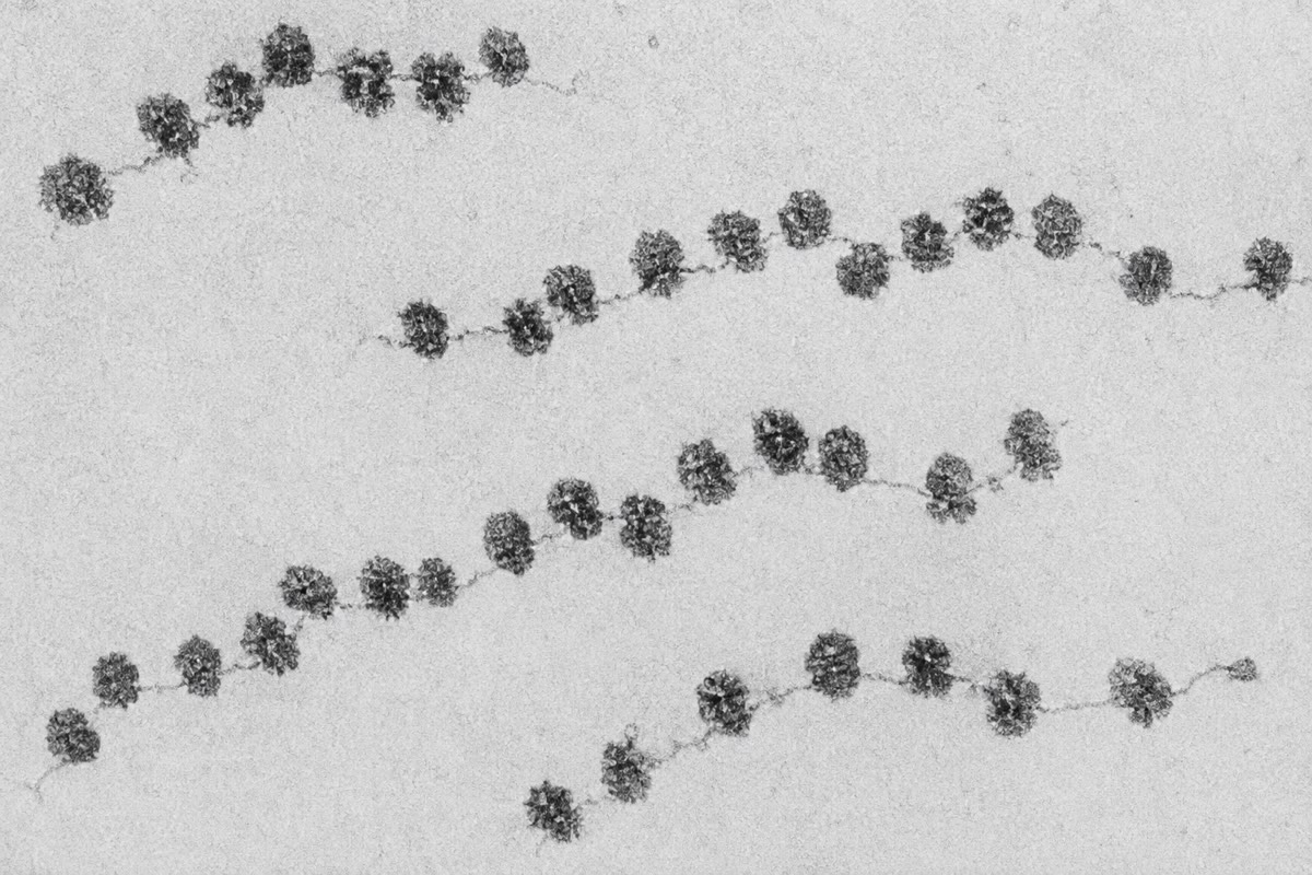 Des polysomes au microscope électronique : des ribosomes enfilés le long d’un messager, chacun faisant sa propre copie de la protéine.