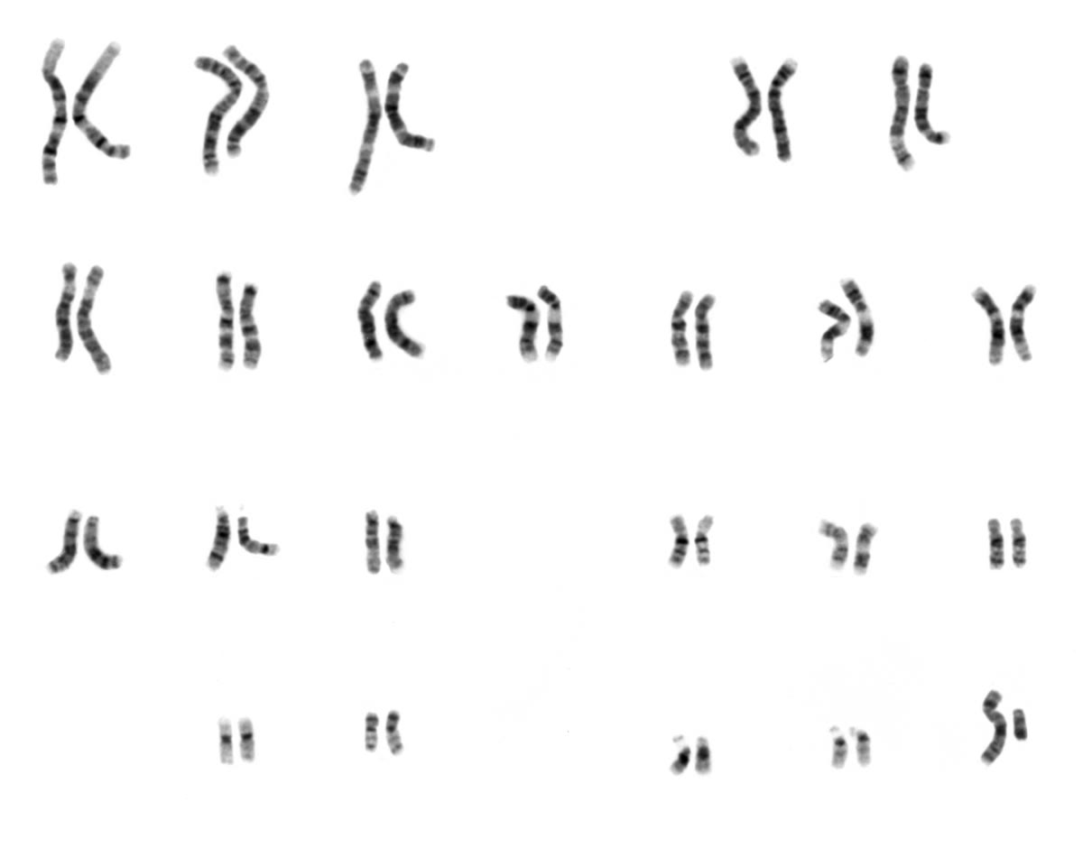Links: de chromosomen van één menselijke cel, uitgespreid vanuit een cel die in de metafase is stilgezet. Rechts: dezelfde chromosomen op grootte en banderingspatroon gesorteerd tot een karyotype — tweeëntwintig paren en XY, zesenveertig in totaal. Karyotype: National Human Genome Research Institute, publiek domein.