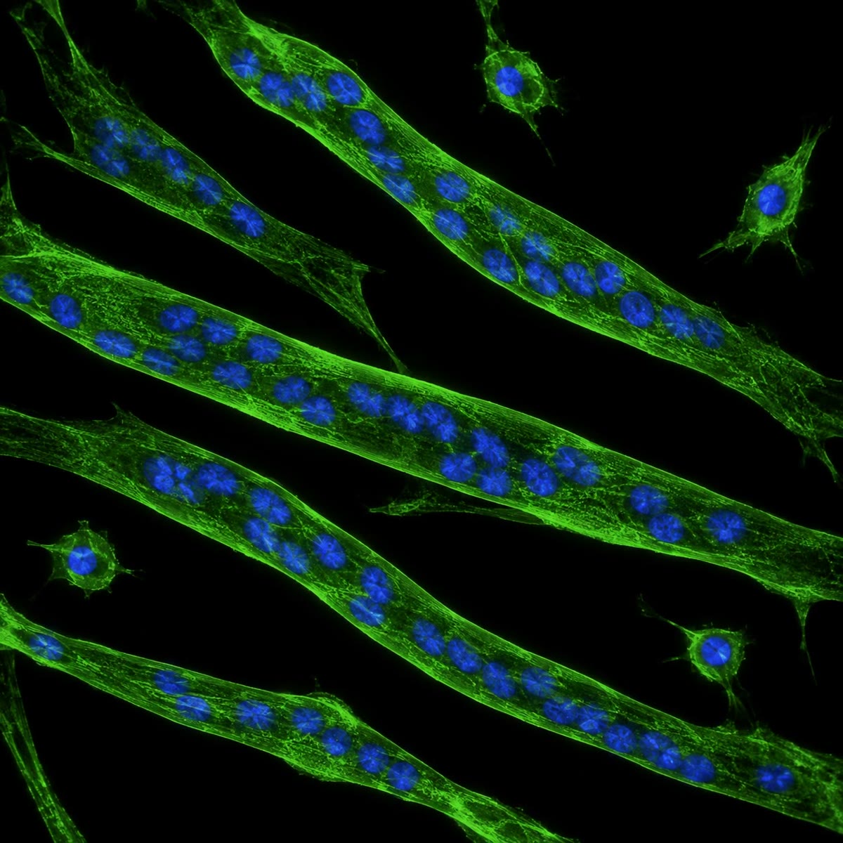 Links: myotubes in kweek, elk een versmolten cel met een rij kernen, naast afzonderlijke myoblasten die nog niet zijn versmolten. Rechts: rijpe vezels in lengteaanzicht, met als dwarsstrepen de zich herhalende sarcomeren en met de kernen naar de rand gedrukt.