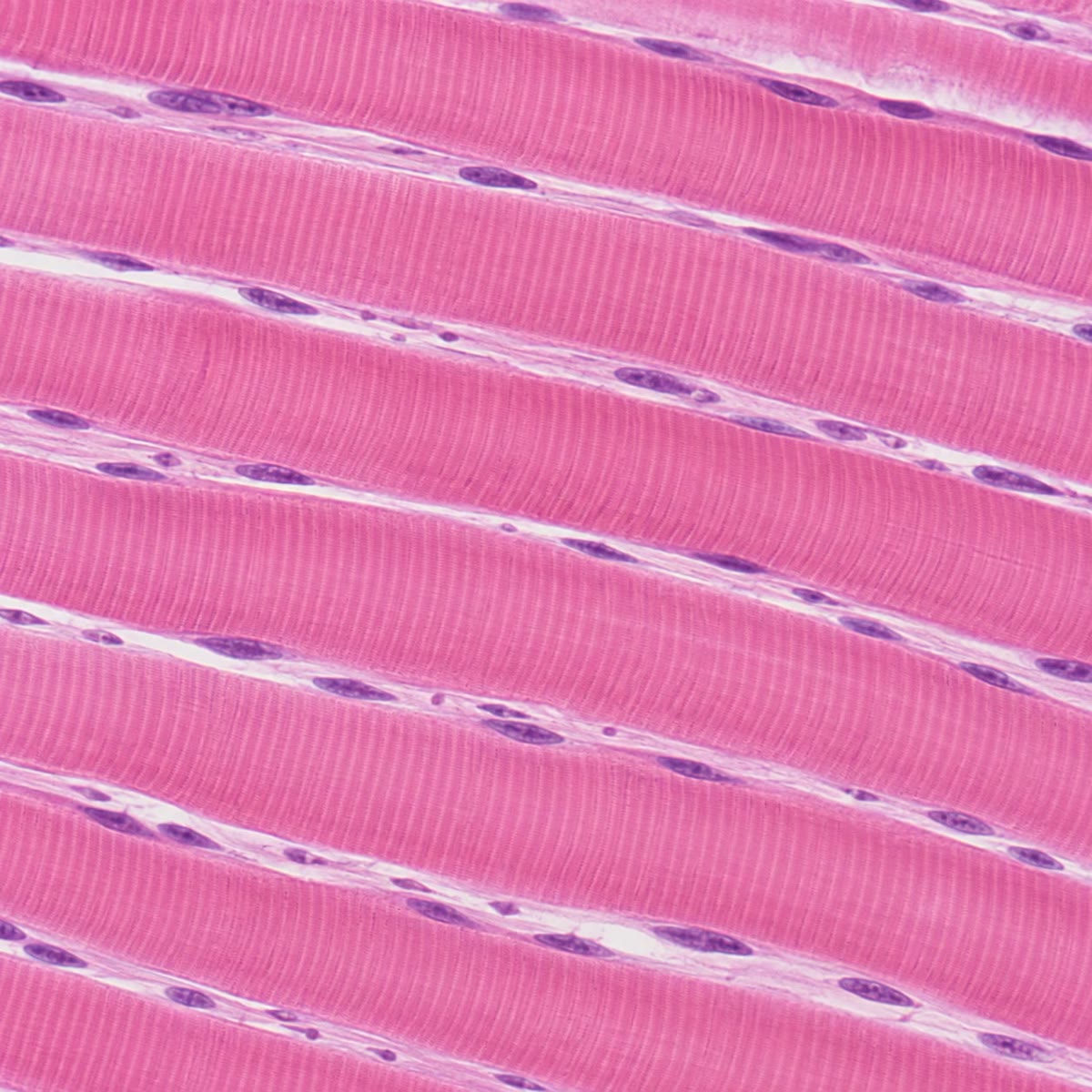 Links: myotubes in kweek, elk een versmolten cel met een rij kernen, naast afzonderlijke myoblasten die nog niet zijn versmolten. Rechts: rijpe vezels in lengteaanzicht, met als dwarsstrepen de zich herhalende sarcomeren en met de kernen naar de rand gedrukt.