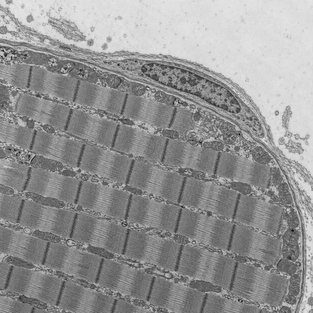 Een satellietcel onder de elektronenmicroscoop: een kleine eenkernige cel, weggestopt tussen het membraan van een spiervezel en zijn basale lamina — de reserve aan myoblasten van de vezel.