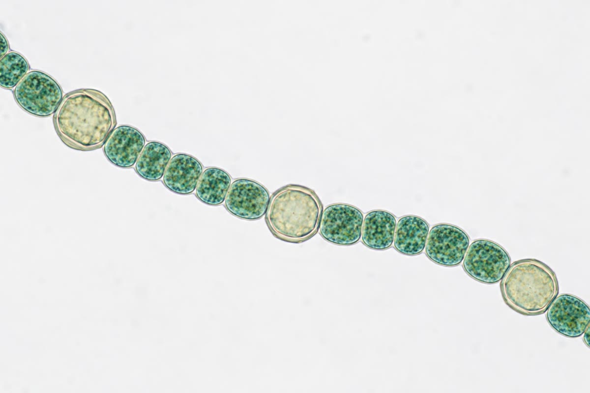 Een draad van Anabaena: een keten van groene fotosynthetische cellen, onderbroken door grotere, blekere heterocysten, de cellen die stikstof binden.