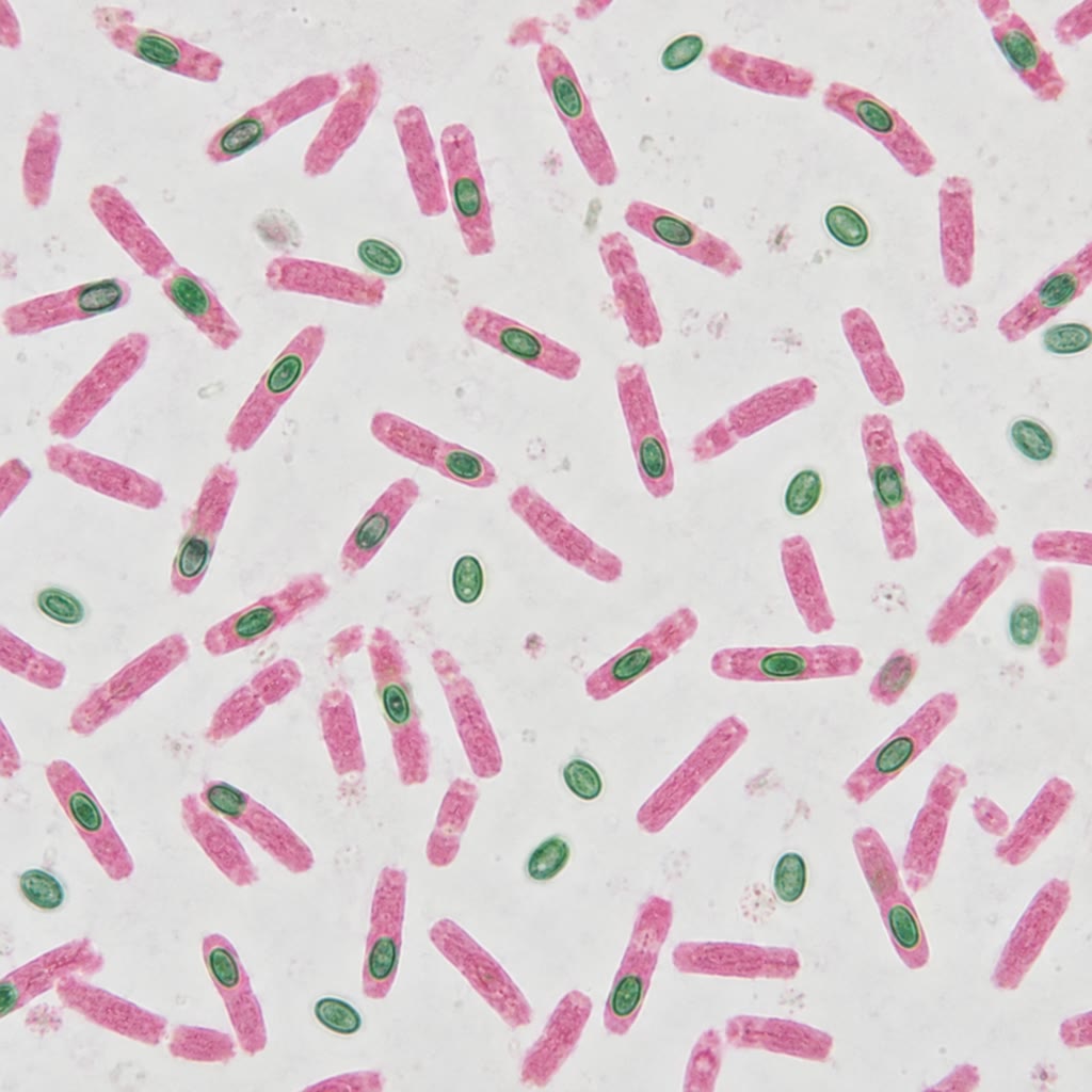 Left: a Gram stain — purple Gram-positive cocci in clusters, pink Gram-negative rods. Right: Bacillus cells stained for endospores, the bright green ovals inside pink cells and free spores beside them.