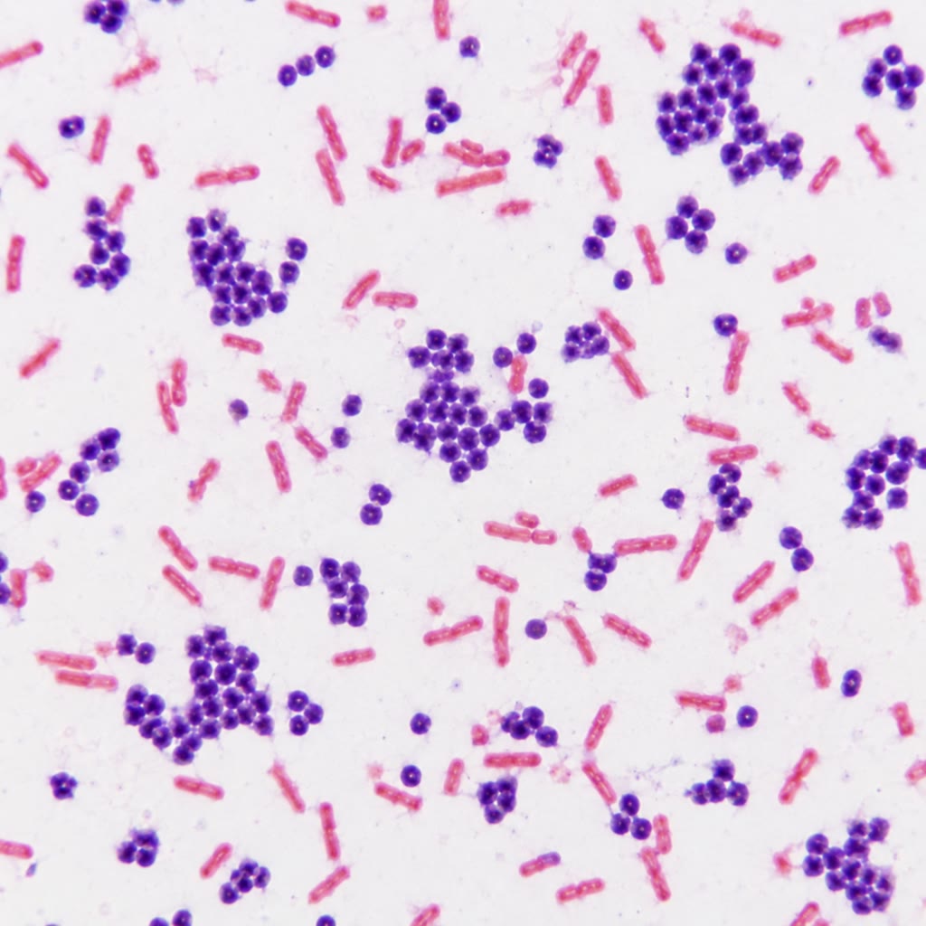 Left: a Gram stain — purple Gram-positive cocci in clusters, pink Gram-negative rods. Right: Bacillus cells stained for endospores, the bright green ovals inside pink cells and free spores beside them.