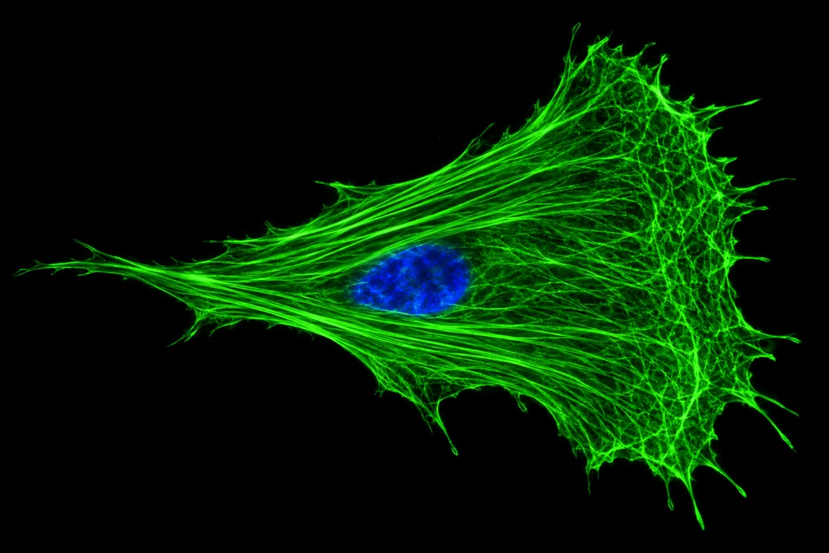 Left: actin (green) in a migrating fibroblast — stress fibres across the body, a dense meshwork at the broad leading edge on the right. Right: microtubules (orange) radiating from the centrosome beside the nucleus (blue) to the cell margin.