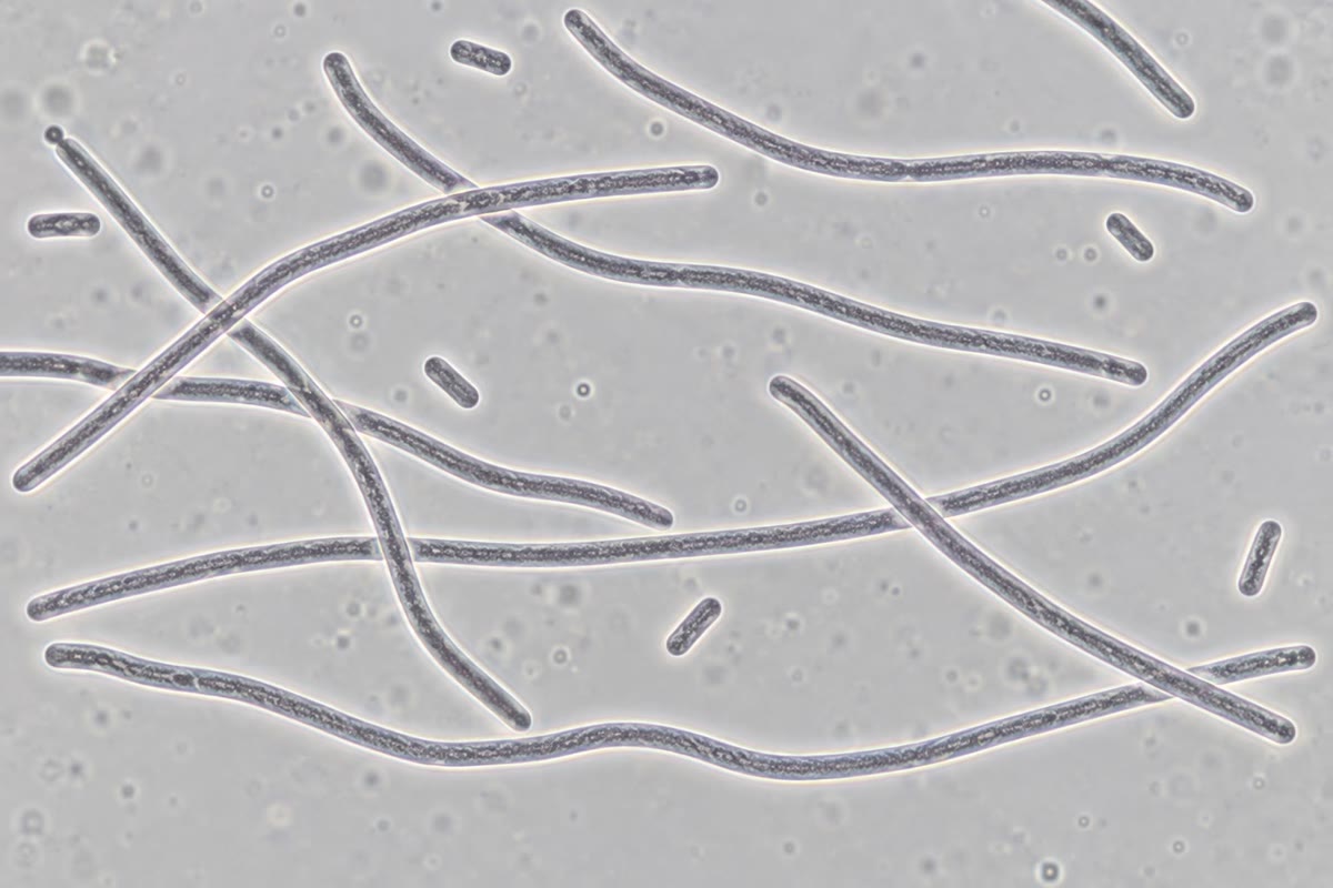 À esquerda: E. coli depois da irradiação ultravioleta, crescida em longos filamentos porque a resposta SOS bloqueou a divisão celular enquanto o DNA é reparado. À direita: um ensaio cometa — células isoladas embebidas num gel e submetidas a eletroforese; o DNA fragmentado escorre para fora do núcleo numa cauda cujo comprimento mede o número de quebras.