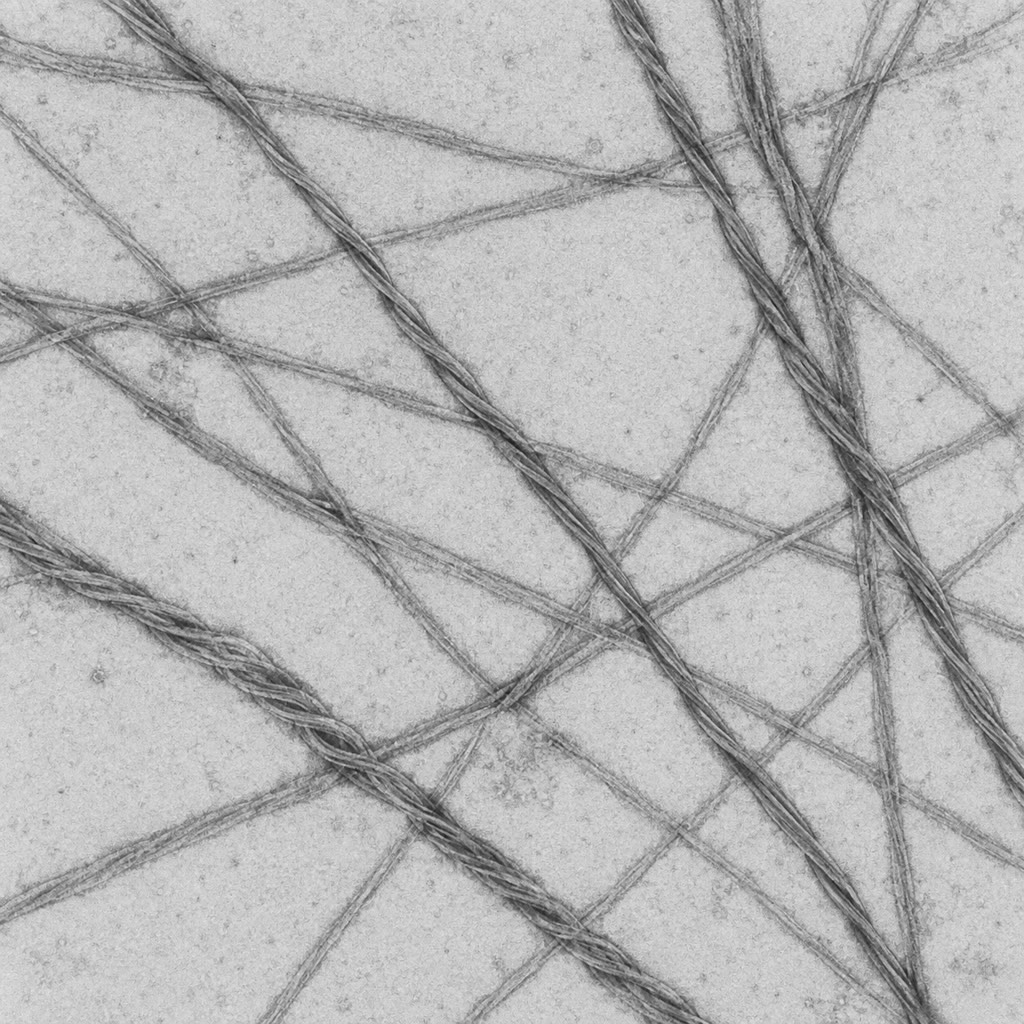 Links: amyloïdvezels in de elektronenmicroscoop — recht, onvertakt, soms gedraaid, en van bouw gelijk uit welk eiwit zij ook bestaan. Rechts: het hemoglobinetetrameer, twee - en twee -ketens, die elk een heem omvatten.